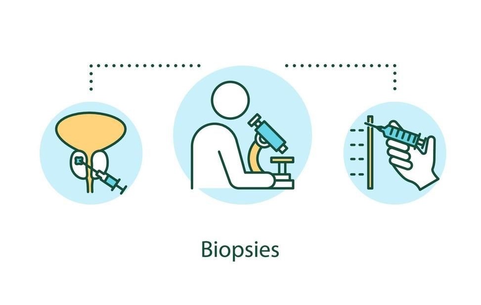 بیوپسی (Biopsy) و انواع آن | مدینیوم